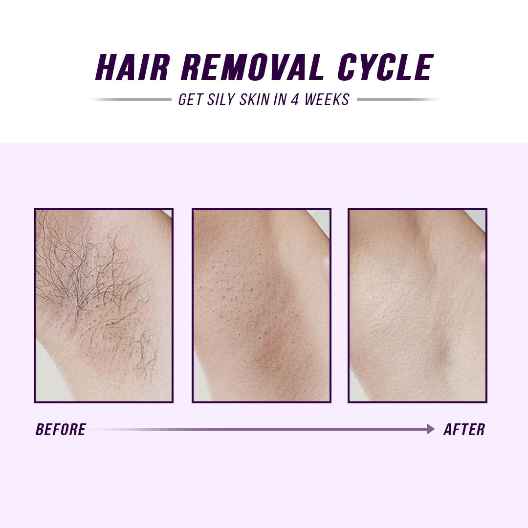 IPL Hair Removal Device